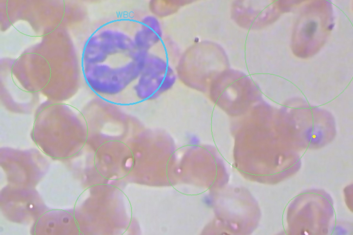 CellVision Blood — detected RBC, WBC and platelets on a reconstructed smear